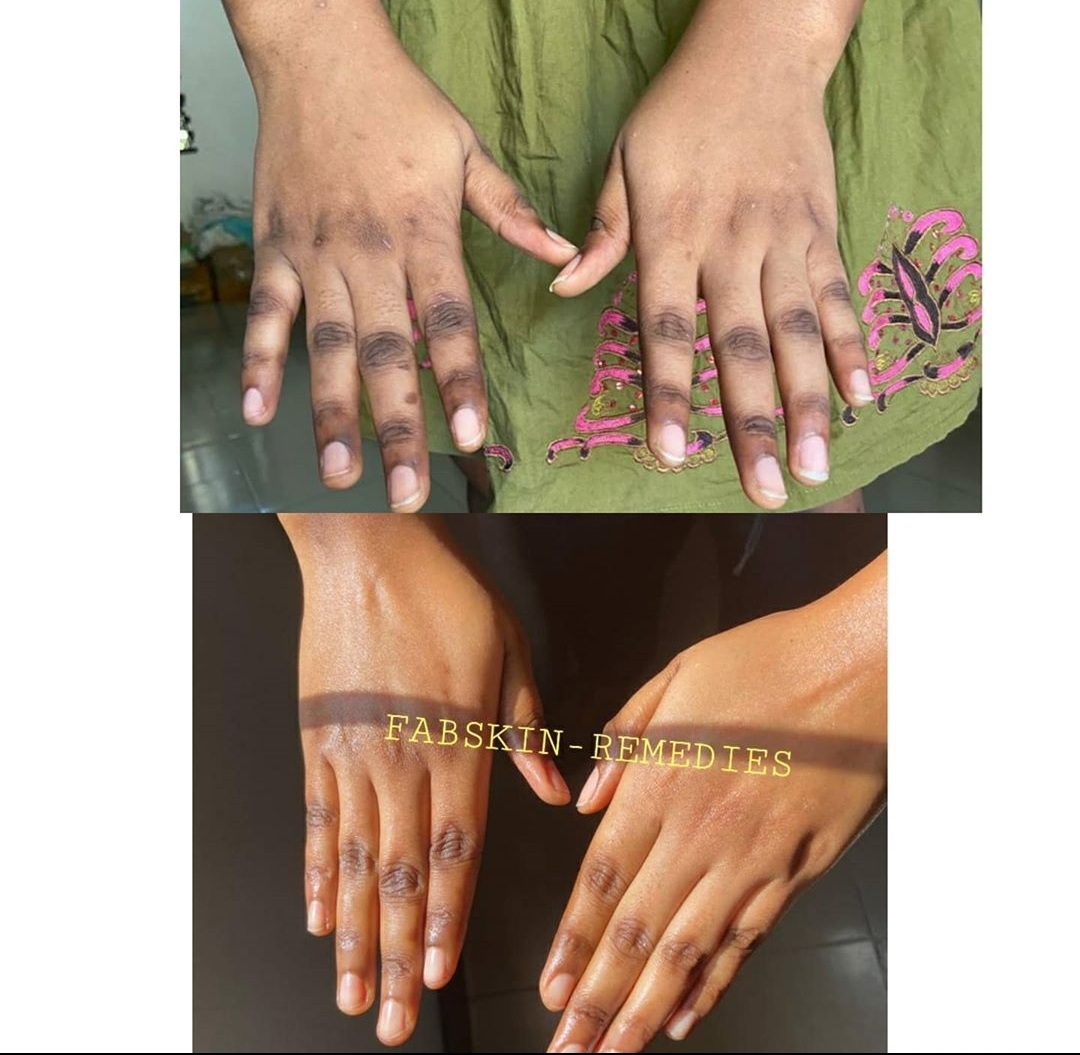 Before & After 1