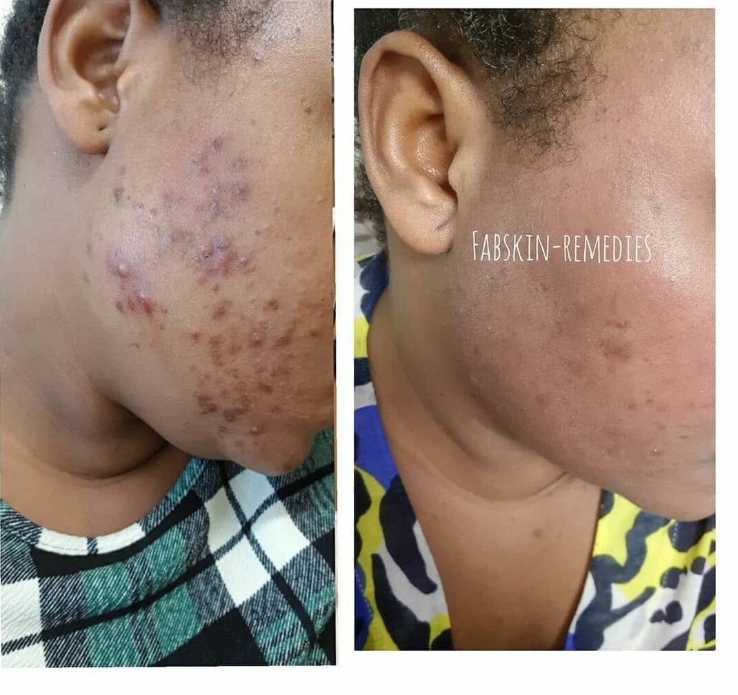 Before & After 2