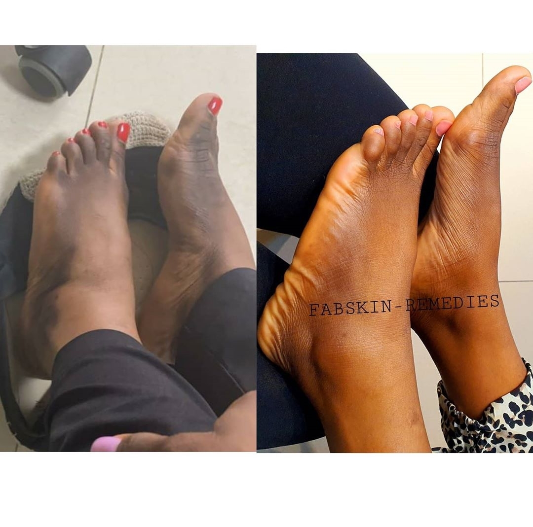 Before & After 6