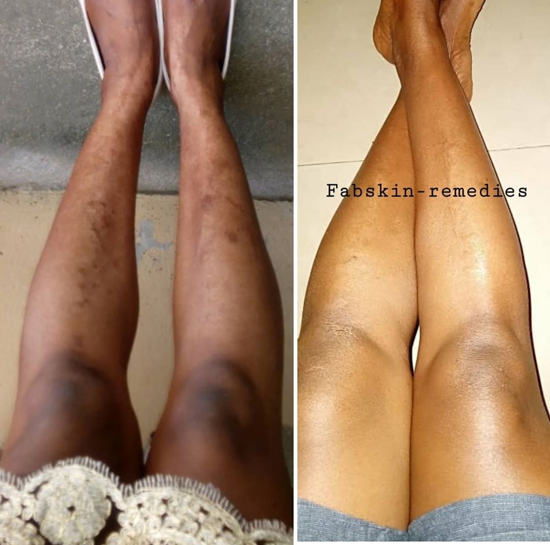 Before & After 7