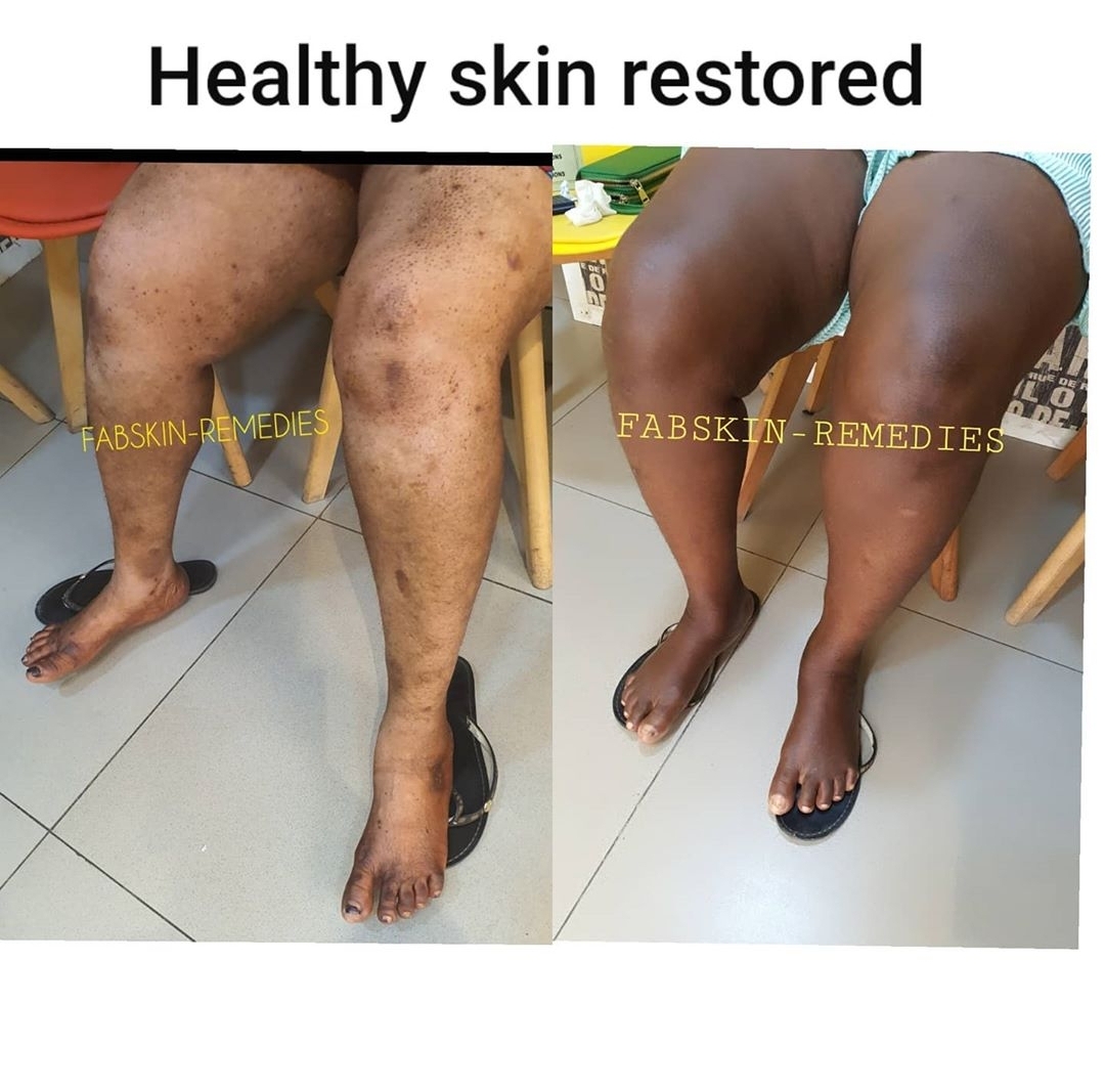 Before & After 8