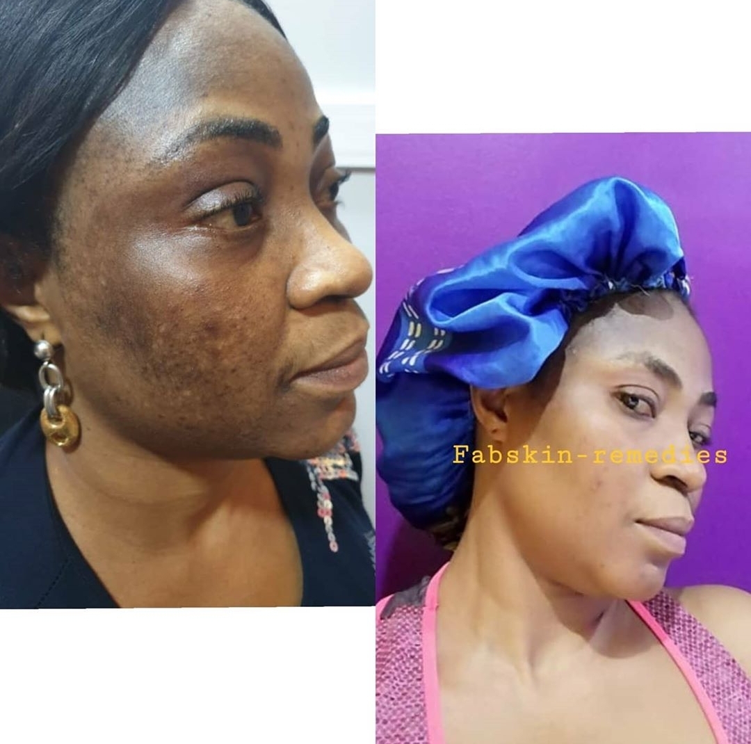 Before & After 9