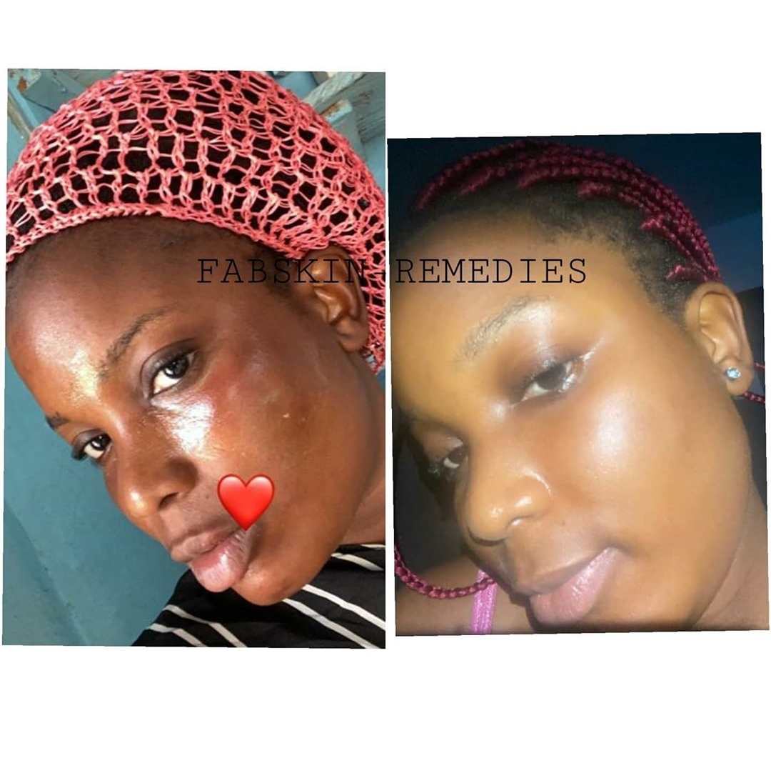 Before & After 11