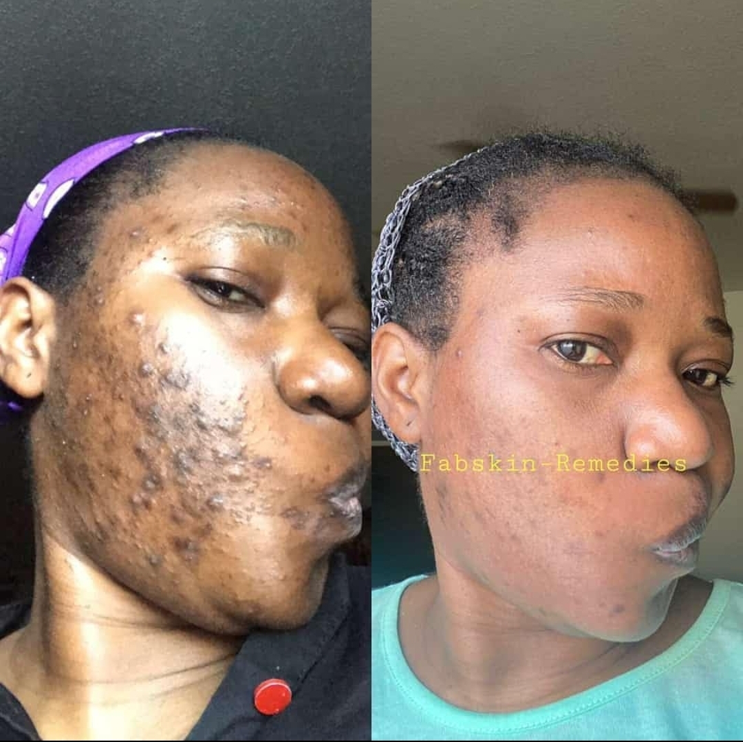 Before & After 12
