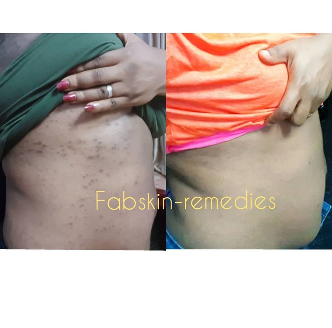 Before & After 15