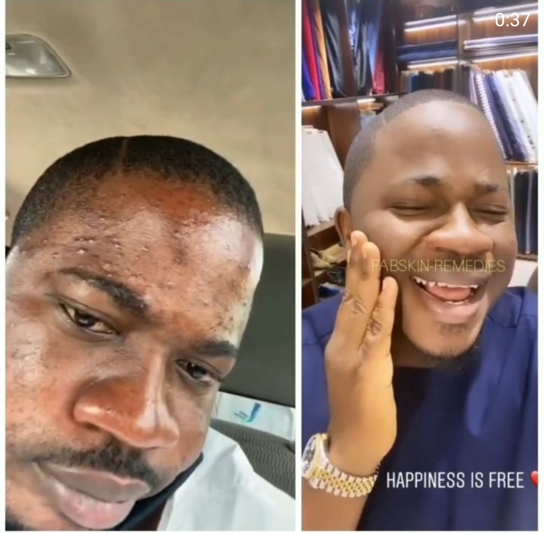 Before & After 20