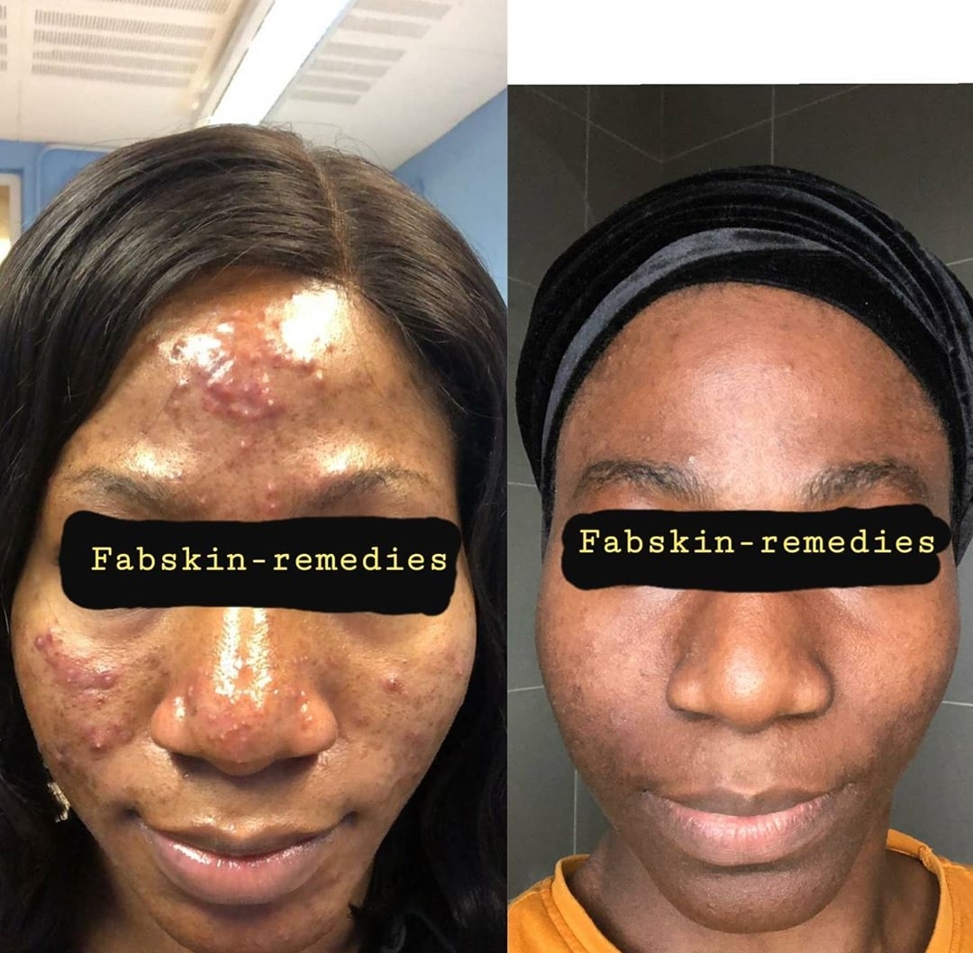 Before & After 17