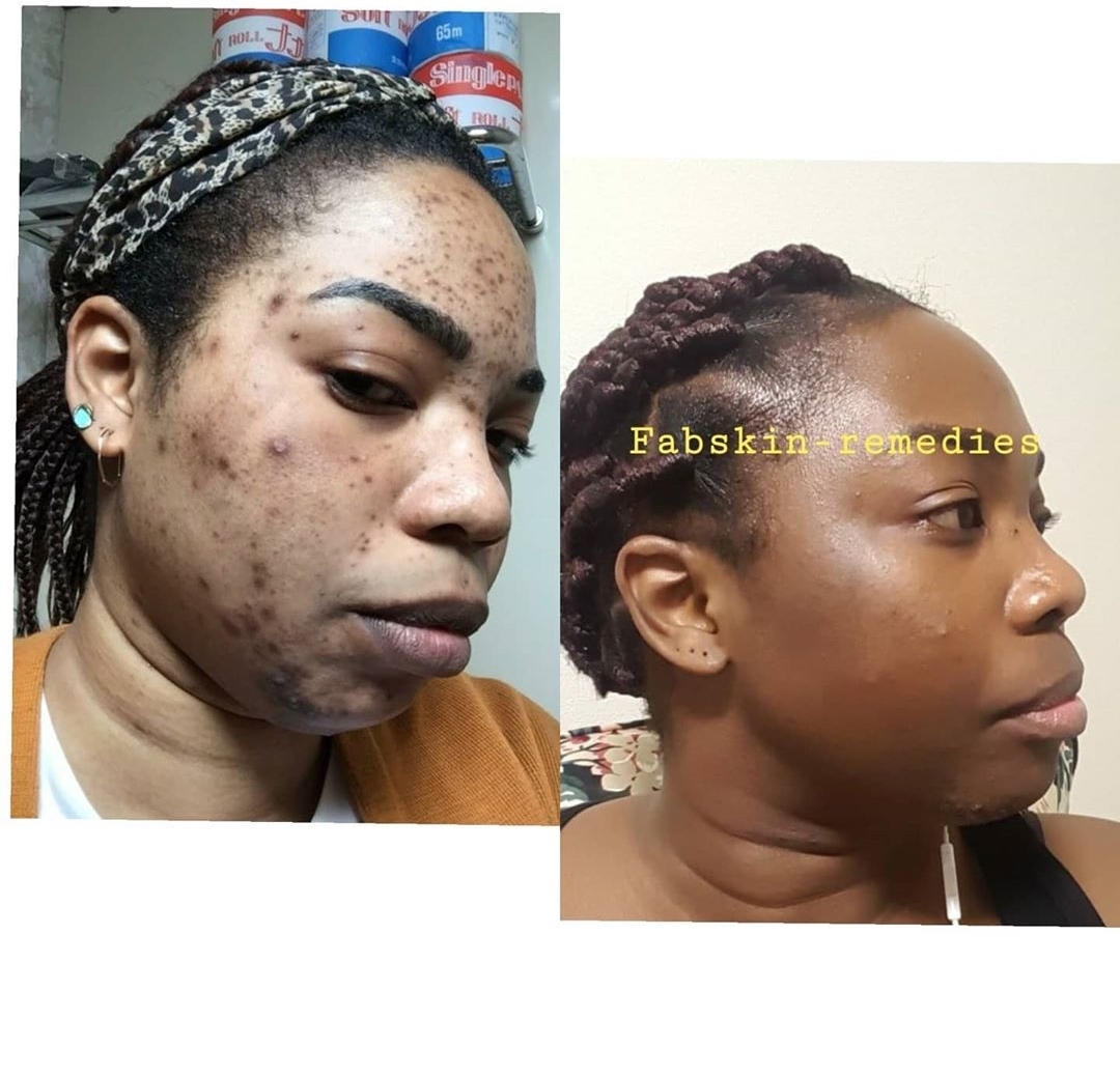 Before & After 16