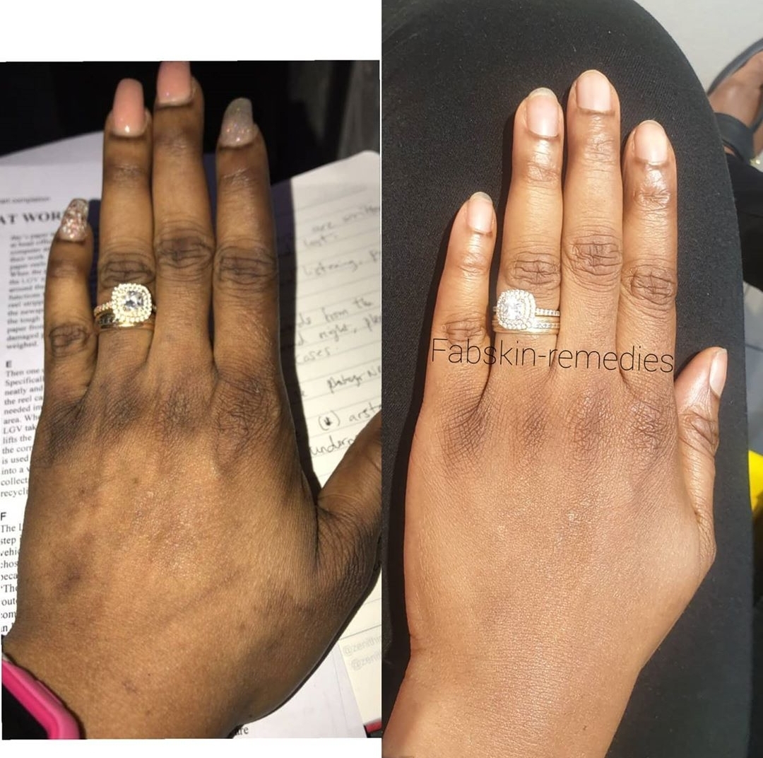 Before & After 18