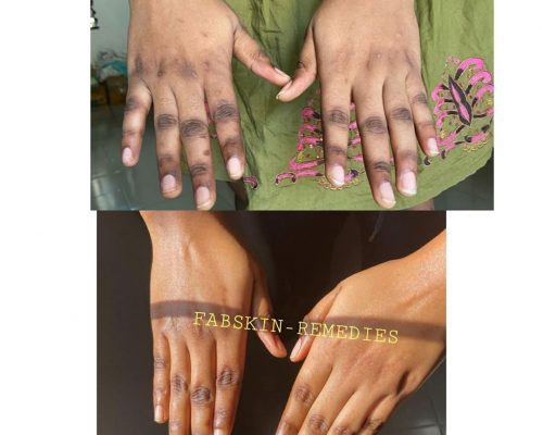 Before & After 1