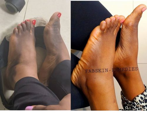 Before & After 6
