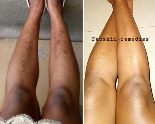 Before & After 7