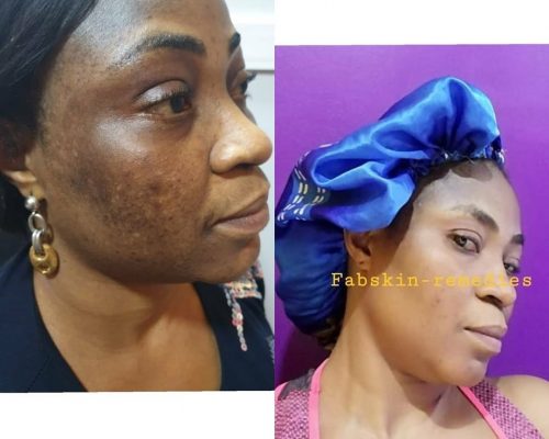 Before & After 9