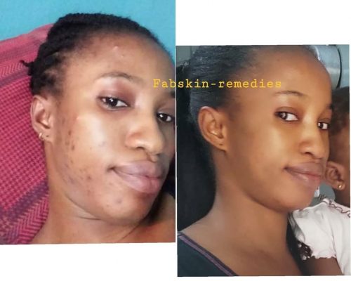 Before & After 10