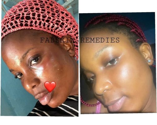 Before & After 11