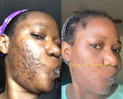 Before & After 12