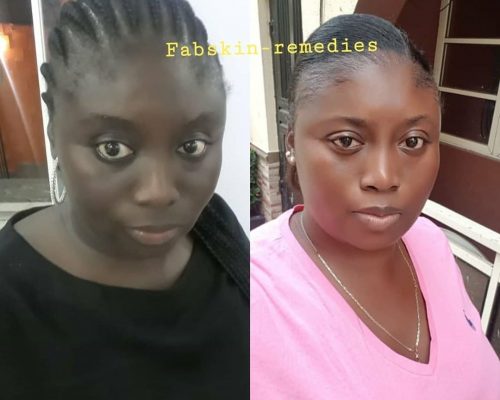 Before & After 14
