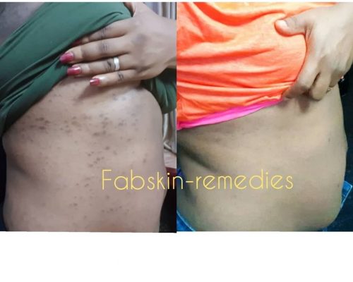 Before & After 15