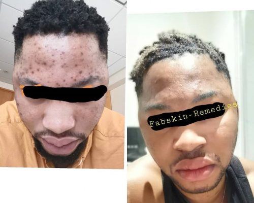 Before & After 19